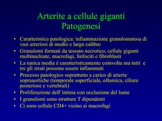 Arterite a cellule giganti Patogenesi Caratteristica patologica: infiammazione granulomatosa di vasi arteriosi di medio e largo calibro Granulomi formati da tessuto necrotico, cellule giganti multinucleate, macrofagi, linfociti e fibroblasti La tunica media è caratteristicamente coinvolta ma tutti  e tre gli strati possono essere infiammati Processo patologico soprattutto a carico di arterie sopraaortiche (temporale superficiale, oftamica, ciliare posteriore e vertebrali) Proliferazione dell’intima con occlusione del lume I granulomi sono strutture T dipendenti Ci sono cellule CD4+ vicino ai macrofagi 