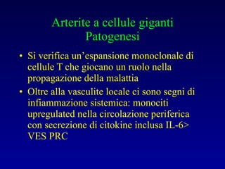 Arterite a cellule giganti Patogenesi Si verifica un’espansione monoclonale di cellule T che giocano un ruolo nella propagazione della malattia Oltre alla vasculite locale ci sono segni di infiammazione sistemica: monociti upregulated nella circolazione periferica con secrezione di citokine inclusa IL-6> VES PRC 