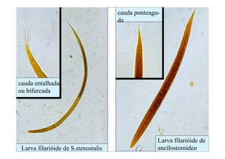 cauda entalhada
ou bifurcada
Larva filarióide de S.stercoralis
Larva filarióide de
ancilostomídeo
cauda ponteagu-
da
 