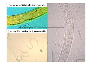 primórdio genital
Larvas filarióides de S.stercoralis
Larva rabditóide de S.stercoralis
 