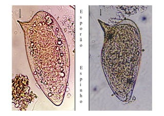 E
s
p
o
r
ã
o
E
s
p
i
n
h
o
 