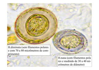 H.diminuta (sem filamentos polares
e com 70 a 80 micrômetros de com-
primento)
H.nana (com filamentos pola
res e medindo de 30 a 40 mi-
crômetros de diâmetro)
 
