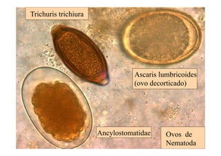 Trichuris trichiura
Ascaris lumbricoides
(ovo decorticado)
Ancylostomatidae Ovos de
Nematoda
 