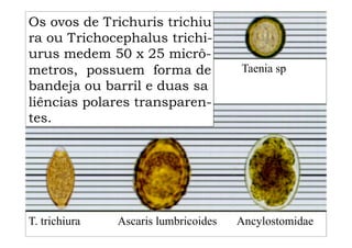 Os ovos de Trichuris trichiu
ra ou Trichocephalus trichi-
urus medem 50 x 25 micrô-
metros, possuem forma de
bandeja ou barril e duas sa
liências polares transparen-
tes.
Taenia sp
T. trichiura Ascaris lumbricoides Ancylostomidae
 
