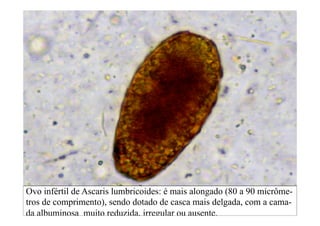 Ovo infértil de Ascaris lumbricoides: é mais alongado (80 a 90 micrôme-
tros de comprimento), sendo dotado de casca mais delgada, com a cama-
da albuminosa muito reduzida, irregular ou ausente.
 