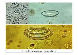 Ovo de Enterobius vermicularis
 