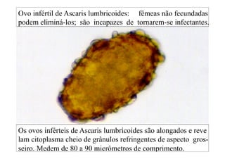 Os ovos inférteis de Ascaris lumbricoides são alongados e reve
lam citoplasma cheio de grânulos refringentes de aspecto gros-
seiro. Medem de 80 a 90 micrômetros de comprimento.
Ovo infértil de Ascaris lumbricoides: fêmeas não fecundadas
podem eliminá-los; são incapazes de tornarem-se infectantes.
 