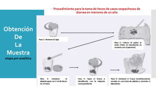  Procedimiento para la toma de heces de casos sospechosos de
diarrea en menores de un año
Obtención
De
La
Muestra
etapa pre-analítica
 