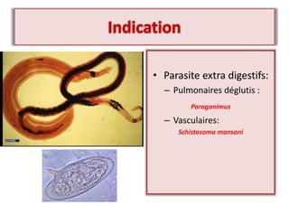 • Parasite extra digestifs:
– Pulmonaires déglutis :
Paragonimus
– Vasculaires:
Schistosoma mansoni
 