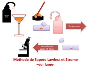 Eau phy
0,9%
HomogénéiserColorant MIF
Immédiat ou
après 20-30mn
Méthode de Sapero Lawless et Strome
–sur lame-
 