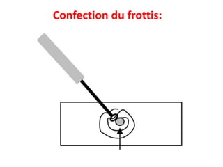 Confection du frottis:
 