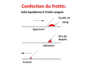 Confection du frottis:
Selle liquidienne→ frottis sanguin
 