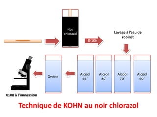 Technique de KOHN au noir chlorazol
Noir
chlorazol
8-10h
Alcool
60°
Lavage à l’eau de
robinet
Alcool
70°
Alcool
80°
Alcool
95°
Xylène
X100 à l’immersion
 