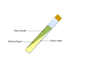 Phase liquide
Élément figuré Phase solide
 