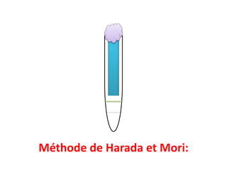 Méthode de Harada et Mori:
 