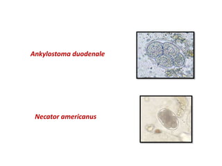 Ankylostoma duodenale
Necator americanus
 