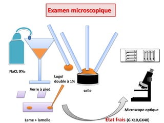 Etat frais (G Χ10,GΧ40)
selleVerre à pied
NaCL 9‰
Microscope optique
Lame + lamelle
Examen microscopique
Lugol
double à 1%
 