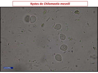 Kystes de Chilomastix mesnili
 