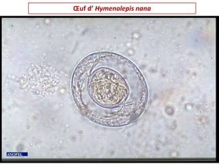 Œuf d’ Hymenolepis nana
 