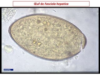 Œuf de Fasciola hepatica
 