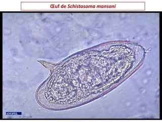 Œuf de Schistosoma mansoni
 