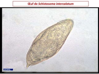 Œuf de Schistosoma intercalatum
 