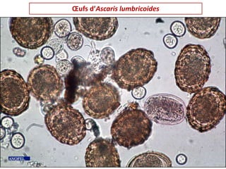 Œufs d’Ascaris lumbricoides
 