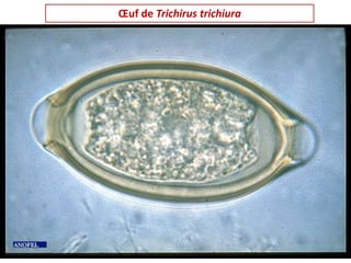 Œuf de Trichirus trichiura
 