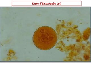 Kyste d’Entamoeba coli
 