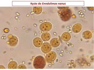 Kyste de Enndolimax nanus
 