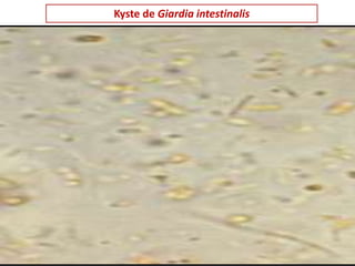 Kyste de Giardia intestinalis
 
