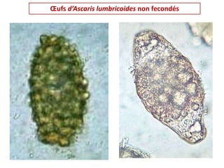 Œufs d’Ascaris lumbricoides non fecondés
 