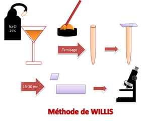 Na Cl
25%
Tamisage
15-30 mn
 