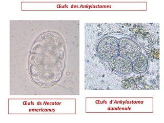 Œufs des Ankylostomes
Œufs d’Ankylostoma
duodenale
Œufs ds Necator
americanus
 