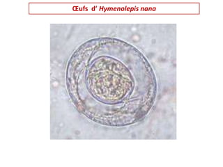Œufs d’ Hymenolepis nana
 