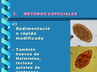 2. MÉTODOS ESPECIALES2. MÉTODOS ESPECIALES
c)c)
SedimentacióSedimentació
n rápidan rápida
modificadamodificada
- TambiénTambién
huevos dehuevos de
Helmintos,Helmintos,
inclusoincluso
quistes dequistes de
 