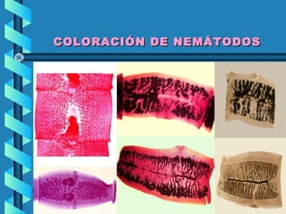 COLORACIÓN DE NEMÁTODOSCOLORACIÓN DE NEMÁTODOS
 