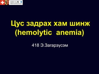 Цус задрах хам шинж
(hemolytic anemia)
418 Э.Загарзүсэм
 