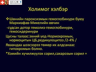 Холимог хэлбэр
Шөнийн пароксизмын гемоглобинури буюу
Маркиафав-Микелийн өвчин
-судсан дотор гемолиз-гемоглобинури,
гемосидеринури
Цусны талаас:эхний үед-Нормохромын,
нормоцитын ЦБ,редикулоцитоз /2-4% /
Яваандаа шээсээрээ төмөр их алдсанаас
гипохромын болно.
*Хэмийн хүчилжүүлэх сорил,сахарозын сорил +
 