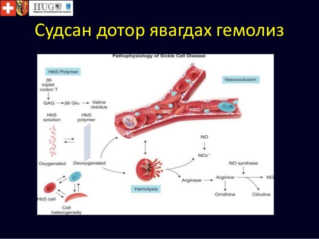 цус задрах хам шинж