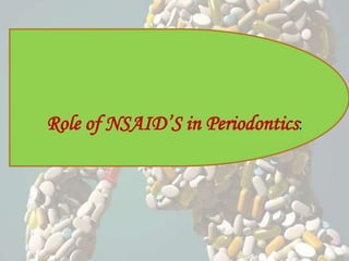 Role of NSAID’S in Periodontics:
 