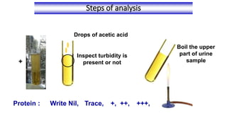 Steps of analysis
Inspect turbidity is
present or not
Drops of acetic acid
Boil the upper
part of urine
sample
Protein : Write Nil, Trace, +, ++, +++,
+
 