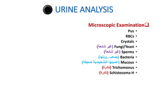 URINE ANALYSIS

Microscopic Examination
•
Pus
•
RBCs
•
Crystals
•
Fungi/Yeast
(
‫شائعة‬ ‫غير‬
)
•
Sperms
(
‫شائعة‬ ‫غير‬
)
•
Bacteria
(
‫رؤيتها‬ ‫يصعب‬
)
•
Mucous
(
‫ضعيفة‬ ‫التشخيصية‬ ‫اهميتها‬
)
•
Trichomonus
(
‫نادرة‬
)
•
Schistosoma H
(
‫نادرة‬
)
 