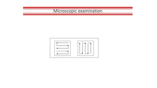 Microscopic examination
 