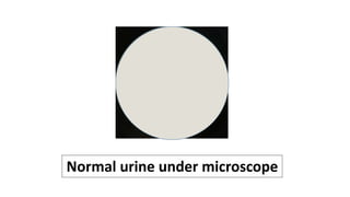 Normal urine under microscope
 
