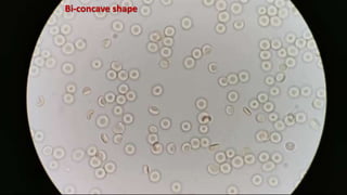Bi-concave shape
 