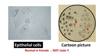 Epithelial cells
Normal in Female .. NOT male !!
Cartoon picture
 