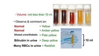 Normal = Yellow
Normal = Amber yellow
Diluted urine/Diabetic = Pale yellow
Bilirubin in urine = Deep yellow
Many RBCs in urine = Reddish
• Observe & comment on:
- Volume: not less than 10 ml
10 ml
 