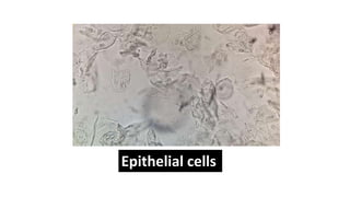 Epithelial cells
 