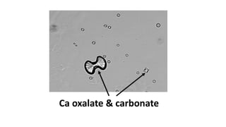 Ca oxalate & carbonate
 